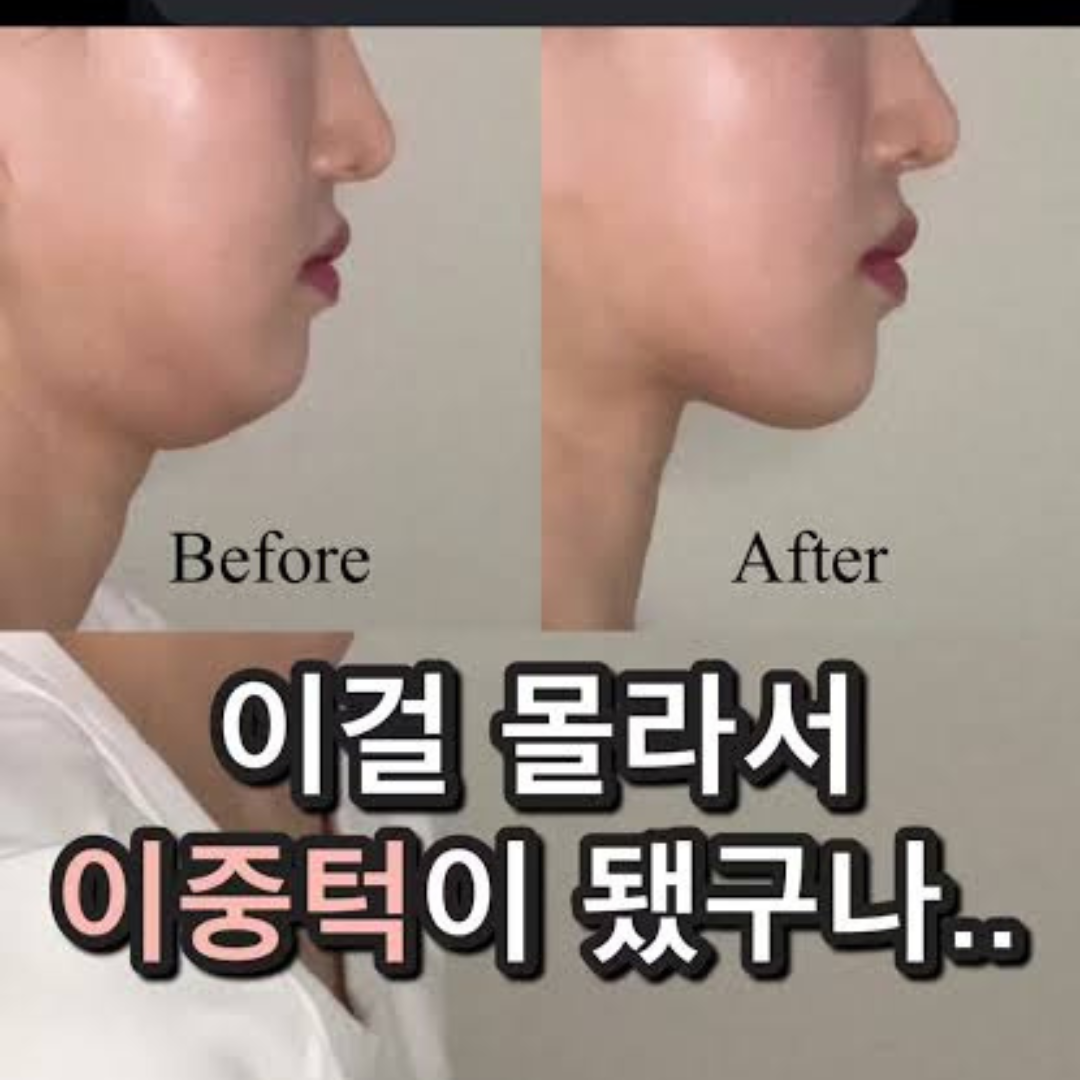 목 지방 감소 방법에 관심 증가